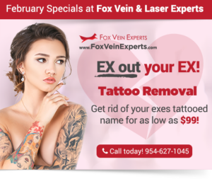 miami tattoo removal