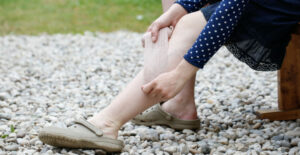 varicose vein treatment