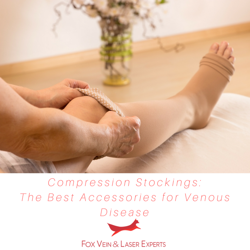 Compression Socks and Venous Disease Miami, FL Fox Vein Experts