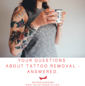 Laser Tattoo Removal  Fewer Treatments Better Results  Miami Skin Spa