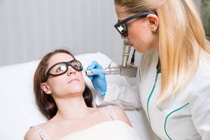 laser treatments for age spot removal