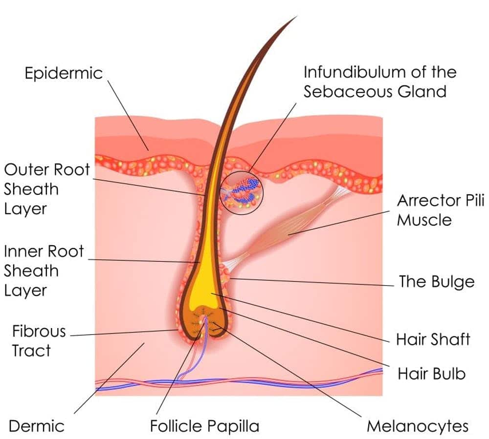 ingrown hairs