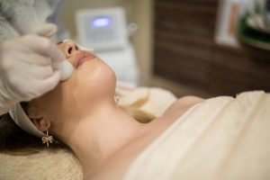 exfoliate after laser hair removal
