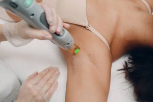 laser hair removal vs waxing
