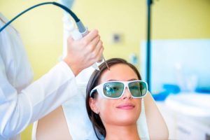 laser hair removal on head