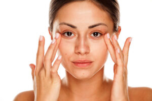 under eyes vein removal