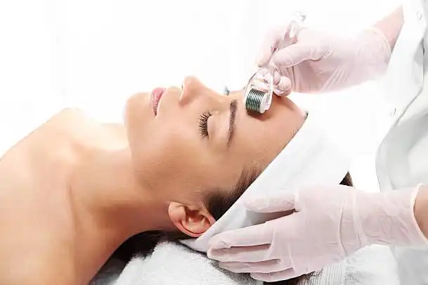 is microneedling safe