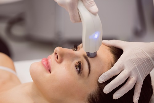 Laser Hair Removal