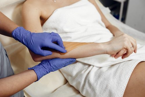 5 Reasons to Switch to Laser Hair Removal From Waxing