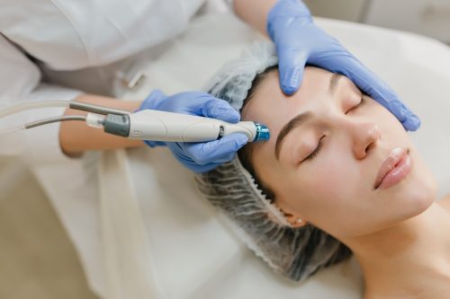 How Long Does Microneedling Last?